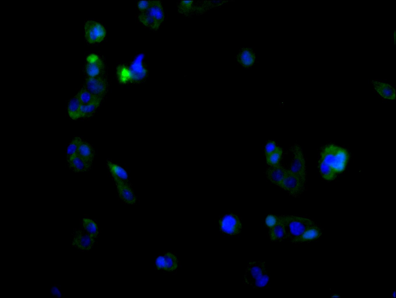 CSB-PA737873LA01HU IF